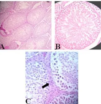 Gambar 3. Gambaran mikroskopis testis kelompok 3: (A) Perbesaran 100x,            (B) 