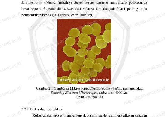 Gambar 2.1 Gambaran Mikroskopik  Streptococcus viridansScanning Electron Microscope http://digilib.unej.ac.idhttp://digilib.unej.ac.idpembesaran 4000 kali (Anonim, 2004:1) 