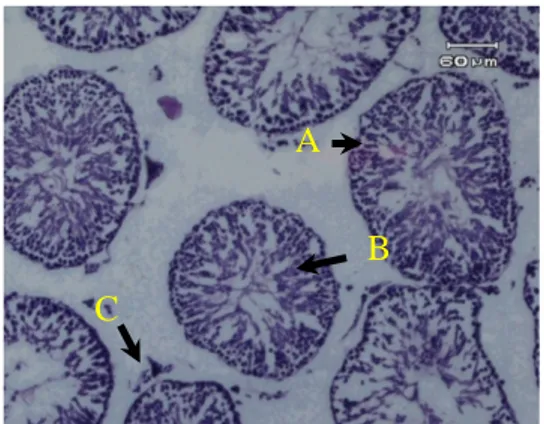 Gambar  6.  Gambaran mikroskopik  testis wistar kelompok F (perlakuan  AAS dosis tinggi selama 6 minggu)