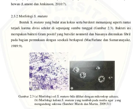 Gambar 2.3 (a) Morfologi sel  S. mutans bila dilihat dengan mikroskop cahaya;   