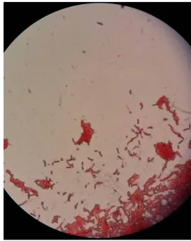 Gambar 2.  Morfologi  Koloni  Bakteri  Pem- Pem-busuk Buah Cabai Rawit 