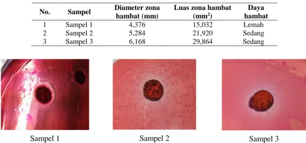 Gambar 2. Hasil Analisa Daya Hambat Bakteri pada Masing-Masing Sampel 