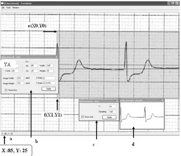 Gambar 10: Seratus data hasil program pengolah citra EKG