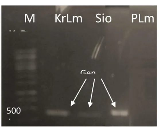 Gambar 1. Hasil Elektroforesis Sampel PCR 
