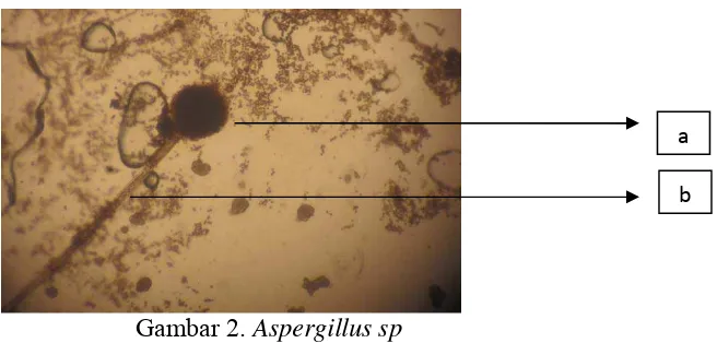 Gambar 2. Aspergillus sp 