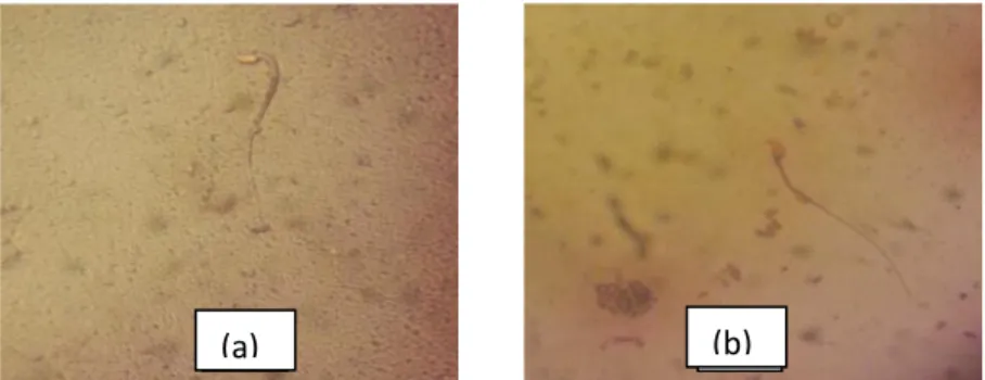 Gambar 1. . Spermatozoa mencit dengan pewarnaan Eosin Negrosin yang diamati dengan mikroskop (perbesaran 