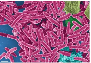 Gambar 3. Bakteri Pseudomonas