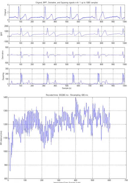Gambar 5. (b) Deteksi QRS dan data interval R-R  pada aktivitas terlentang selama 5 menit 