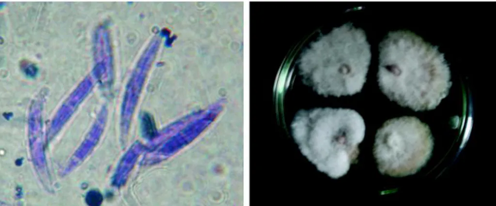 Gambar 4. Gejala yang berasosiasi dengan Fusarium sp. pada daun tanaman garut; gejala  awal  (kiri),  gejala  lanjut  pada  daun  tua  (tengah),  dan  tanaman layu  (kanan).
