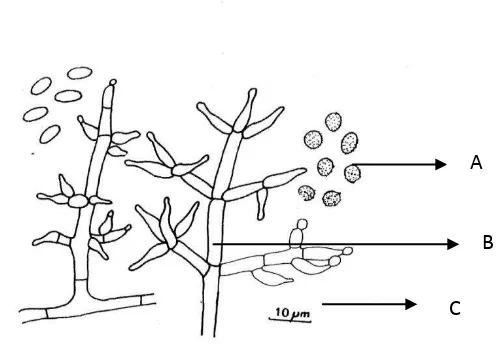 Gambar 11- Morfologi mikroskopis Trichoderma spp. 
