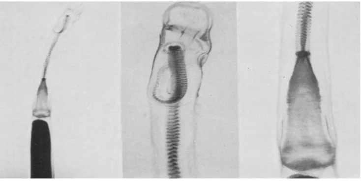 Gambar 9.  Irisan Melintang Lengan danUjung Lengan Hectocotylus
