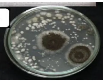 Gambar 3​.​ ​Jamur​ Aspergillus sp ​pada media SDA (Muchsin, 2017). 