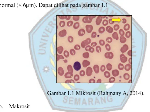 Gambar 1.1 Mikrosit (Rahmany A, 2014).  