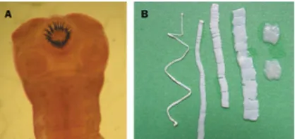 Gambar 1. Scolex (A) dan Cacing pita dewasa (B) (Garcia et al. 2003)