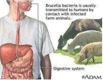Gambar 2. Penularan brucellosis dari hewan ke manusia.