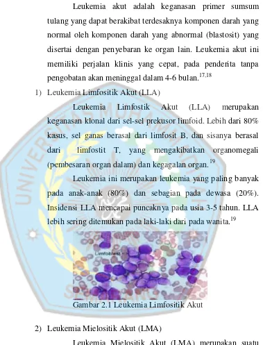 Gambar 2.1 Leukemia Limfositik Akutkut