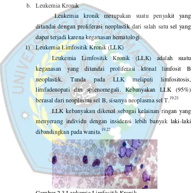 Gambar 2.2 Leukemia Mielositik Akutkut