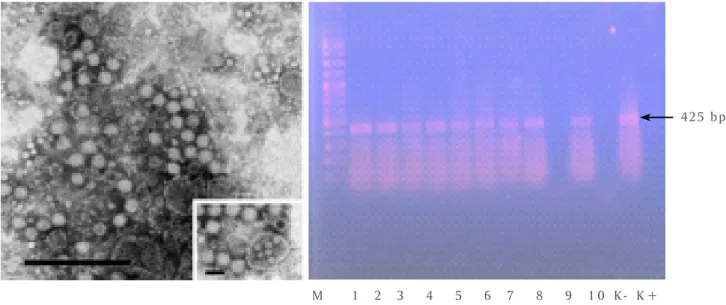 Gambar 1.   Morfologi virus MrNV dan amplifikasi RT-PCR benih udang galah yang terinfeksi WTD (M = Marker; 1-4 = sampel PL- PL-5—10, sampel PL-15—25; K- = kontrol negatif, K+ = kontrol positif)