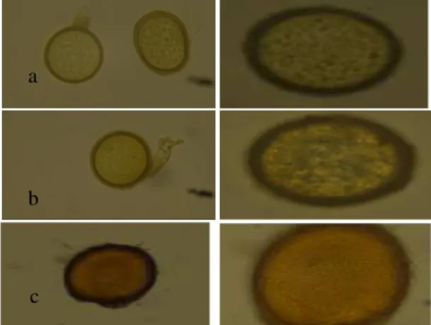 Gambar  7. Foto bentuk spora FMA jenis Acaulospora (a:  A.scrobiculata, b: A. tuberculata, c: A