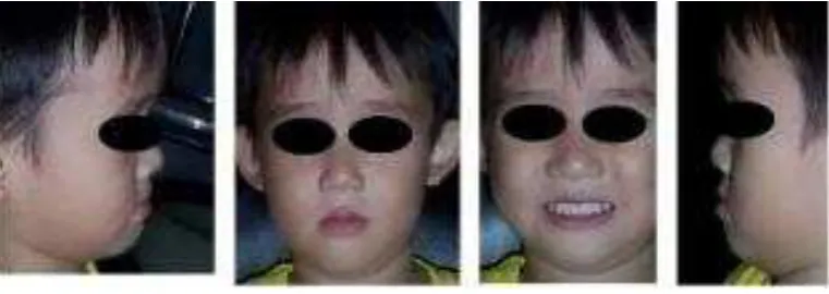 Gambar 4. Foto Wajah 