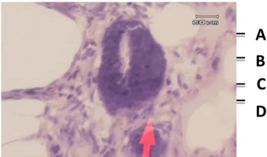 Gambar  3a.  Gambaran mikroskopik payudara 