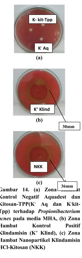 Gambar 7.  Hasil  Analisis  SEM Nanopartikel Klindamisin-Kitosan Uji Aktivitas Antibakteri terhadap Propionibacterium acnes