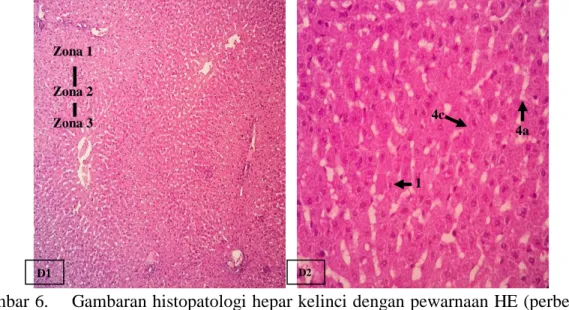 Gambar 6.    Gambaran histopatologi hepar kelinci dengan pewarnaan HE (perbesaran 10x  dan 40x); (A1 dan A2) kontrol negatif dimana hepatositnya (1) terlihat normal;  (B1 dan B2) hiperkolesterolemia dimana, terlihat adanya degenerasi lemak (2),  degenerasi