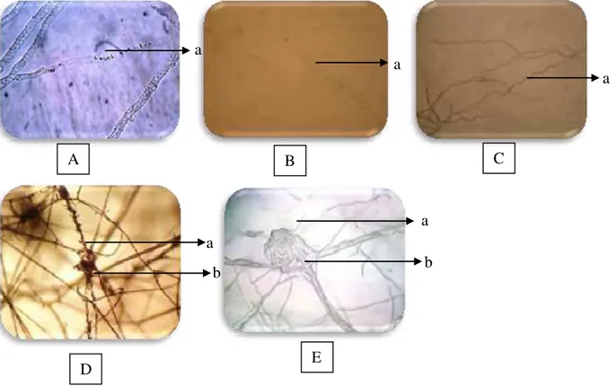 Gambar  1:  Interaksi    antara    jamur    endofit    dan    F.  oxysporum.  (A)    dan  (B)    hifa      patogen  berwarna 