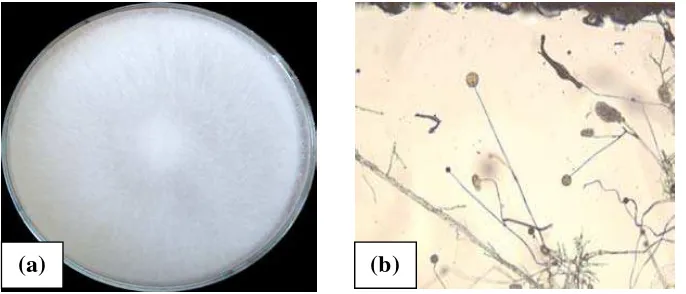 Gambar 5. (a) Pertumbuhan Saprolegnia sp. pada media PDA, (b) Saprolegnia sp. pada hasil pengamatan mikroskopis