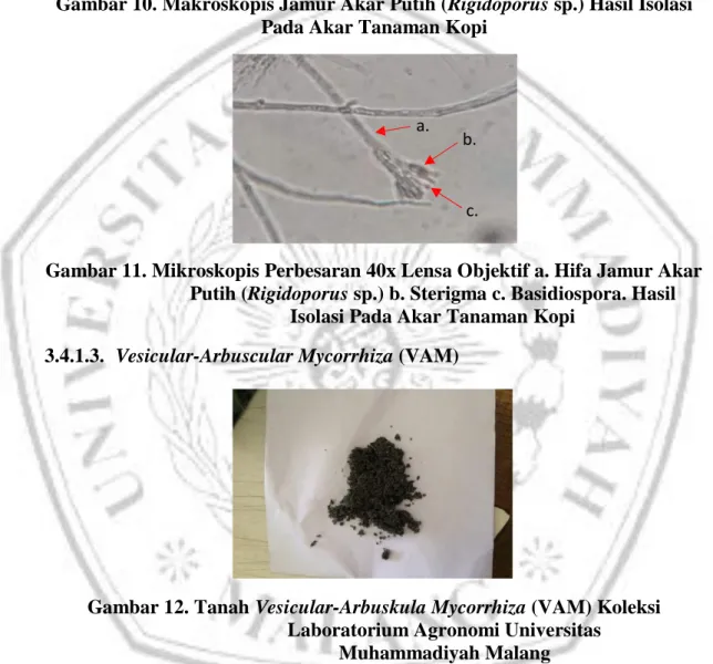 Gambar 11. Mikroskopis Perbesaran 40x Lensa Objektif a. Hifa Jamur Akar  Putih (Rigidoporus sp.) b