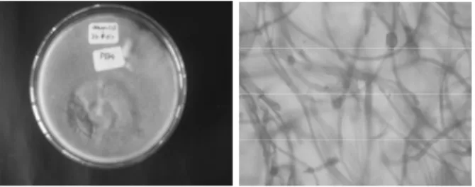 Gambar 3: Koloni dan gambar mikroskopi  kapang patogen  Phytophthora infestans pada  medium PDA  