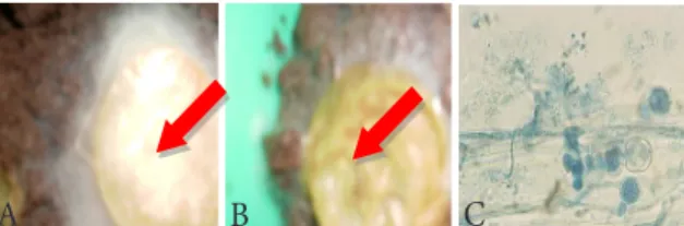 Gambar 1. Potongan buah mentimun yang ditumbuhi oleh miselium  patogen  Pythium sp. (a &amp; b), (c) miselium patogen 