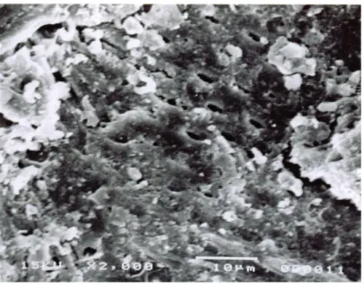 Gambar 1. Abu yang menutupi permukaan arang aktif, diamati dan diukur dengan                           mikroskop elektron 