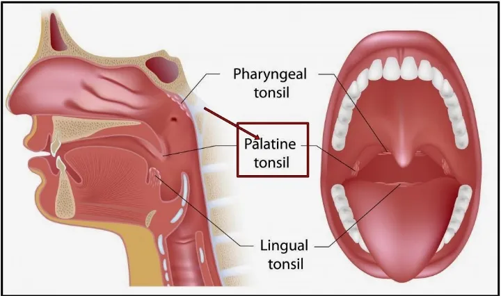 Gambar 2.1 Anatomi Tonsil