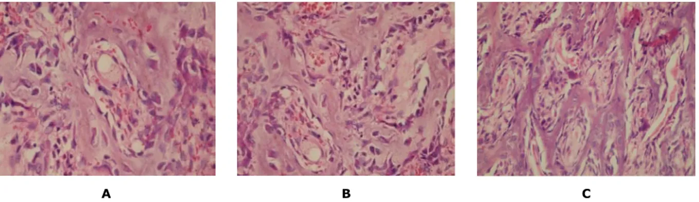 Gambar  1.  Sediaan  Histopatologi  Anatomi  jumlah  sel  osteoblas  pada  pengamatan  7  hari  (400x):  (A)  tanpa kitosan, (B) dengan kitosan gel 1%, (C) dengan kitosan gel 2%.