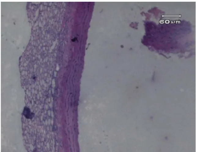 Gambar 3.  Gambaran histologi aorta tikus  wistar kelompok perlakuan I dengan  pembesaran  10x memperlihatkan tidak adanya  sel  busa pada lapisan tunika intima dan tunika  media