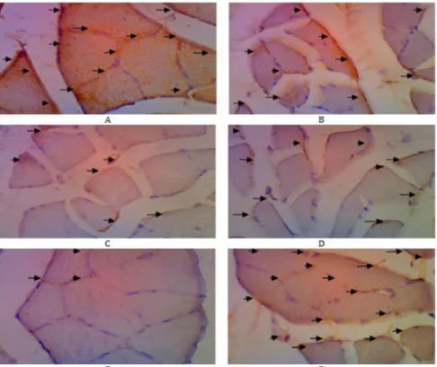 Gambar 3. Hasil fotomikroskopi translokasi protein GLUT-4 pada soleus muscle dengan perbesaran 400  kali (bercak coklat) pada masing-masing kelompok perlakuan; (a) Kombinasi I, (b) Ekstrak terpurifikasi  herba sambiloto, (c) Ekstrak terpurifikasi herba peg