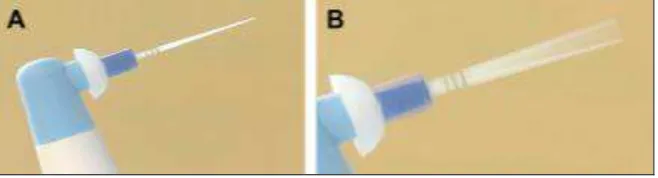 Gambar 7. Vibringe irigator menghasilkan   vibrasi sonik pada syringe dan   jarum7 