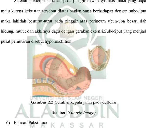 Gambar 2.2 Gerakan kepala janin pada defleksi.  Sumber: (Google Image). 