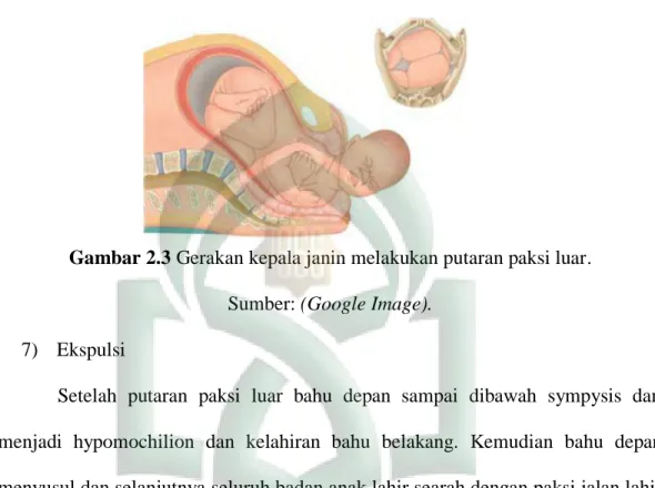 Gambar 2.3 Gerakan kepala janin melakukan putaran paksi luar.  Sumber: (Google Image)