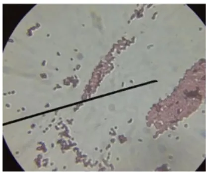 Gambar 1. Hasil pewarnaan gram Eschericia  coli pada perbesaran 10x100  