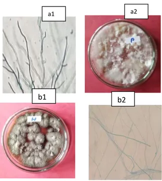 Gambar 1. Isolat Jamur Endofit daun beluntas (Pluchea indica (L.) Less.). Diperoleh duaisolat  jamur endofit, yaitu (a1) Isolat Jamur Endofit Putih, (a2) Hasil pengamatan Mikroskopik Isolat  Jamur Endofit Putih, (b1) Isolat Jamur Endofit Hitam, (b2) Hasil 