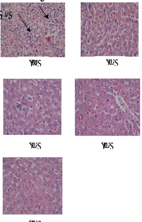 Gambar  1.  Efek  ekstrak  etanolik  Physalis  angulata  L.  terhadap  gambaran  histopatologi  sel    hepar  terinduksi  DMBA