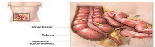 Gambar 2.1. Appendiks pada saluran pencernaan  