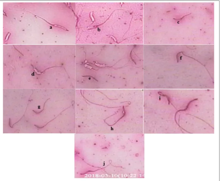 Gambar 2. Bentuk-bentuk spermatozoa ayam kampung yang diberikan penambahan sarang semut