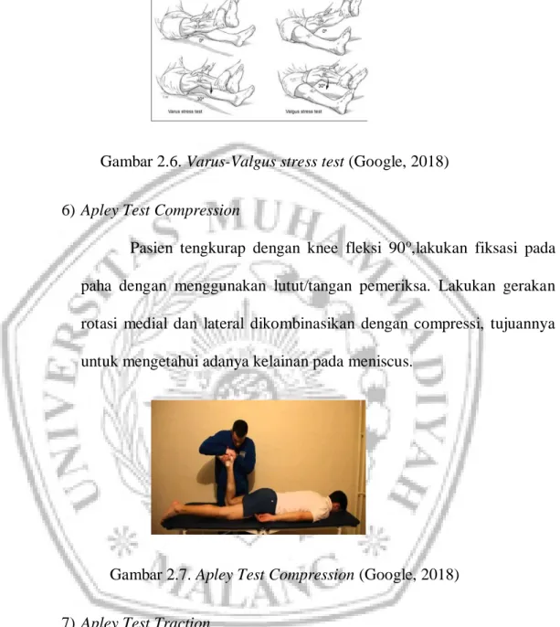 Gambar 2.6. Varus-Valgus stress test (Google, 2018)  6) Apley Test Compression 