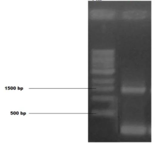 Gambar  1.  Elektroforegram    amplifikasi  gen  18s  rRNA  specimen Octolasmis cor dalam 1% gel agarose  (Keterangan: 1kb = DNA Ladder, Octolasmis cor  =O.cor)