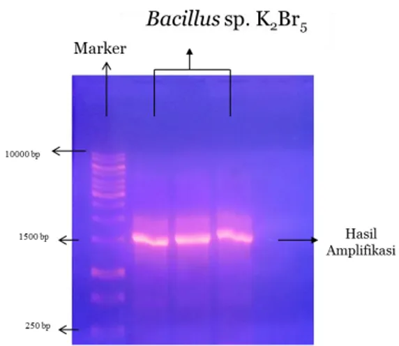 Gambar 2. Pita elektroforesis Bacillus sp.K 2 Br 5