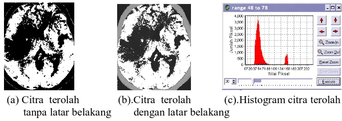 Gambar 6. Citra Hasil  Perentangan Kontras 