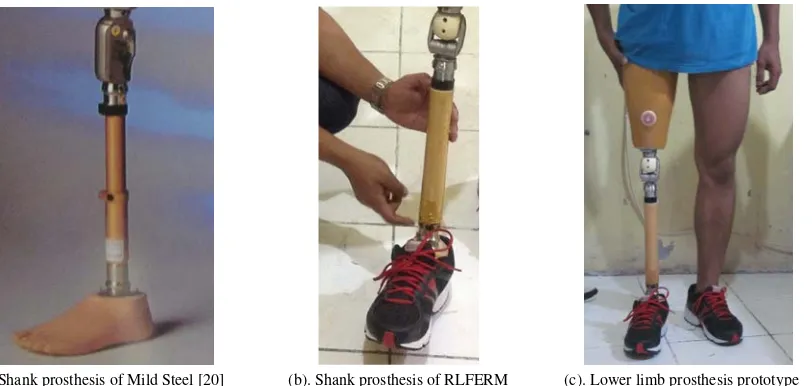 Fig. 9. Shank prosthesis endoskeletal type 
